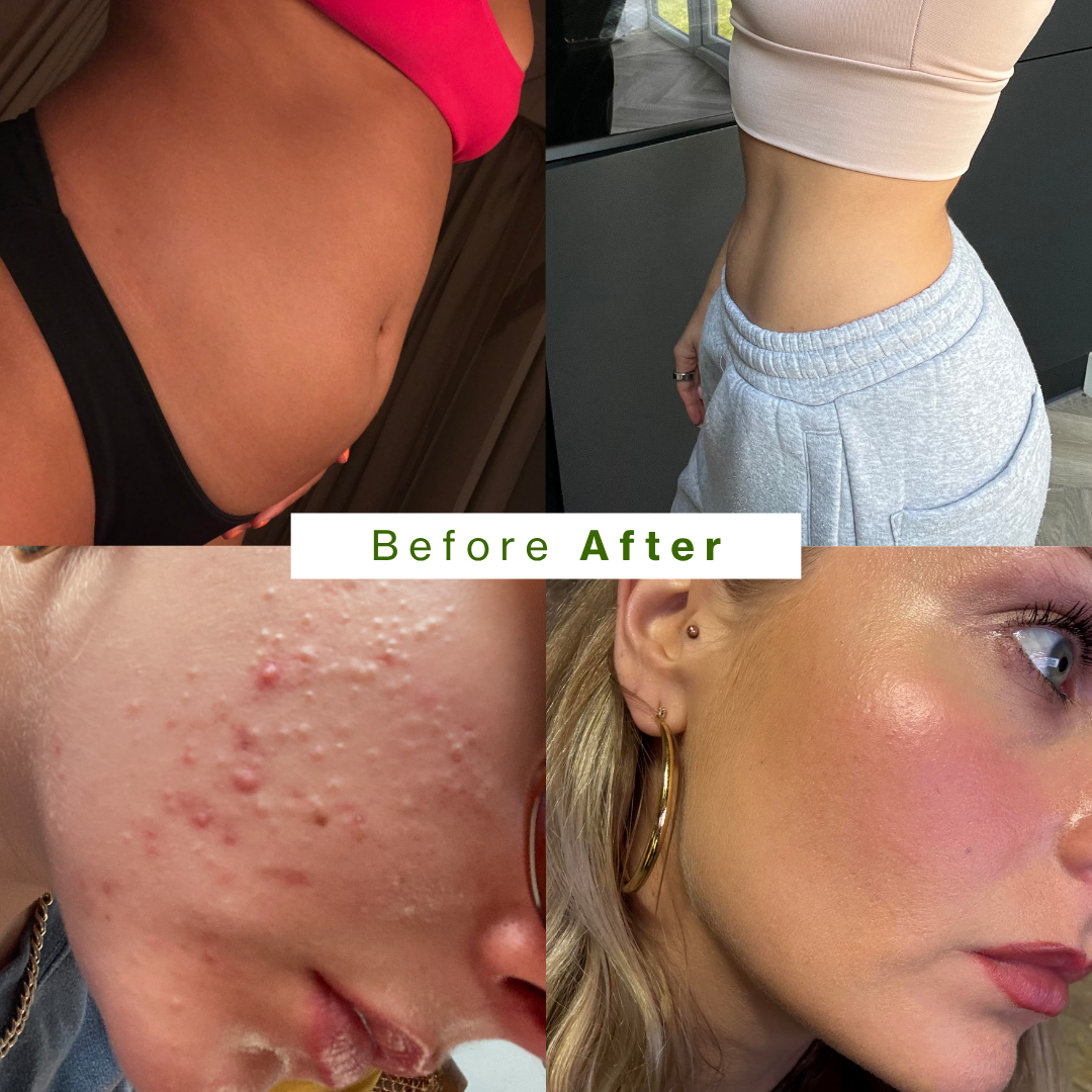 Before and after photos: a bloated stomach and clearer, glowing skin.